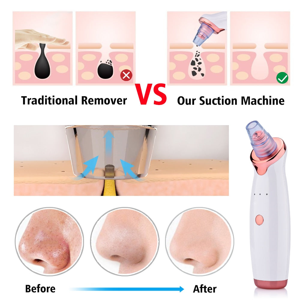 Blackhead Instrument Electric Suction Facial Washing Beauty