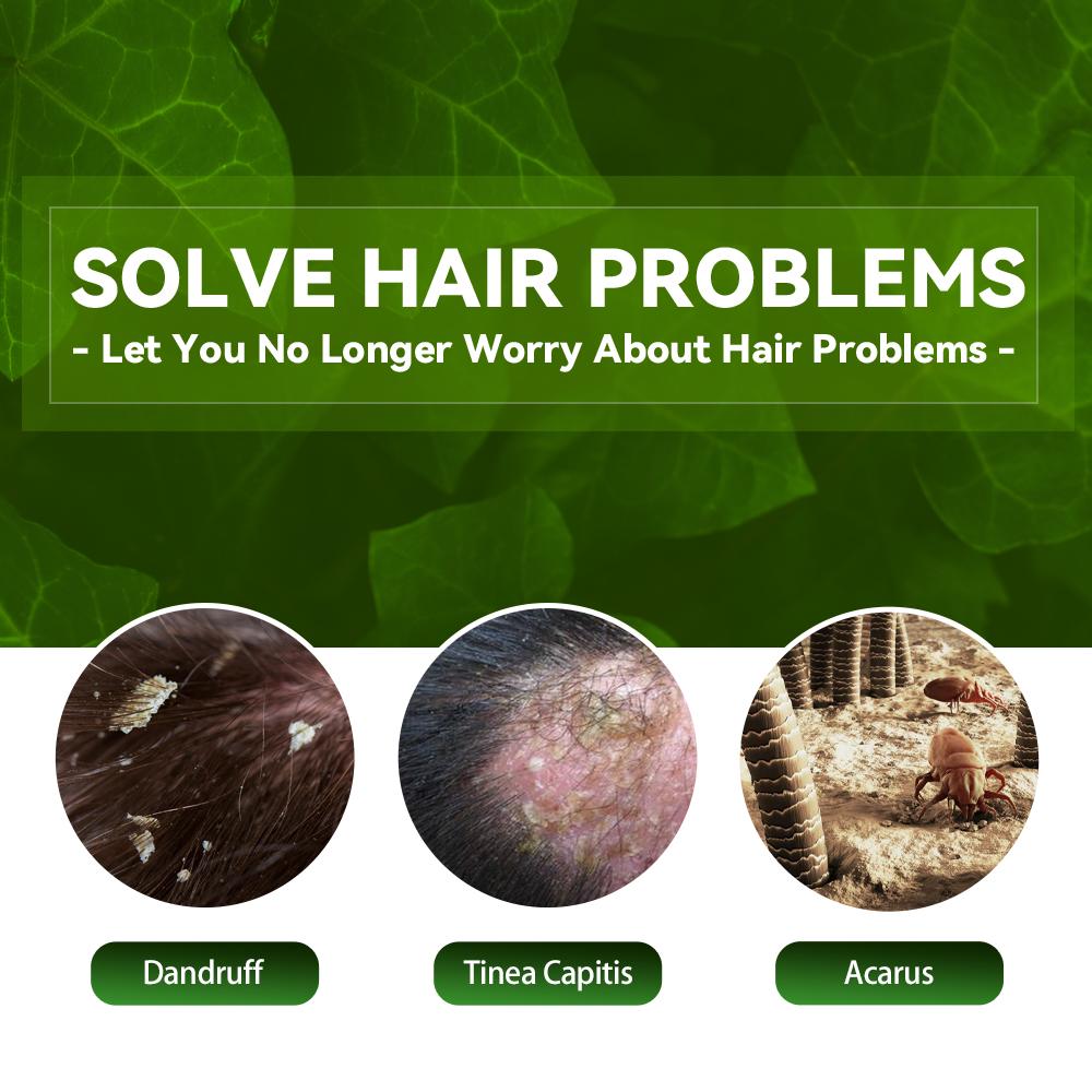 EELHOE Anti-Dandruff Shampoo Itch Relief, Hair Loss