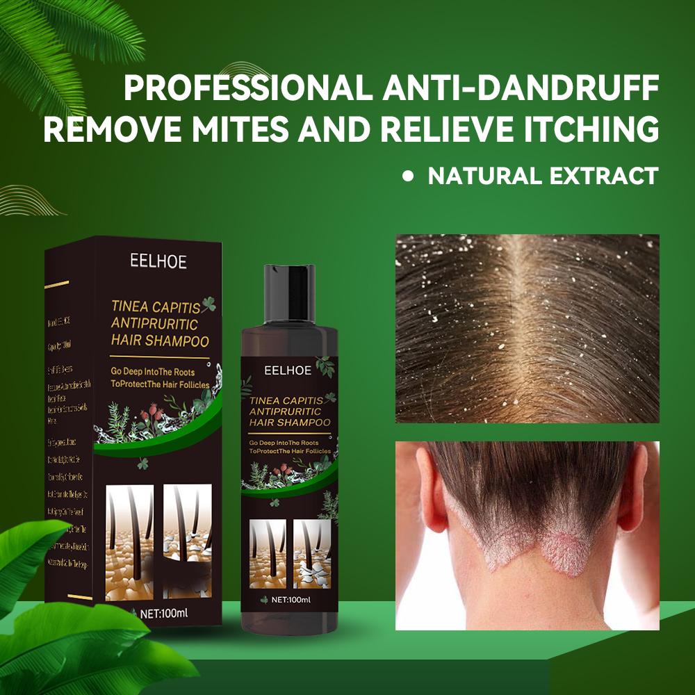 EELHOE Anti-Dandruff Shampoo Itch Relief, Hair Loss