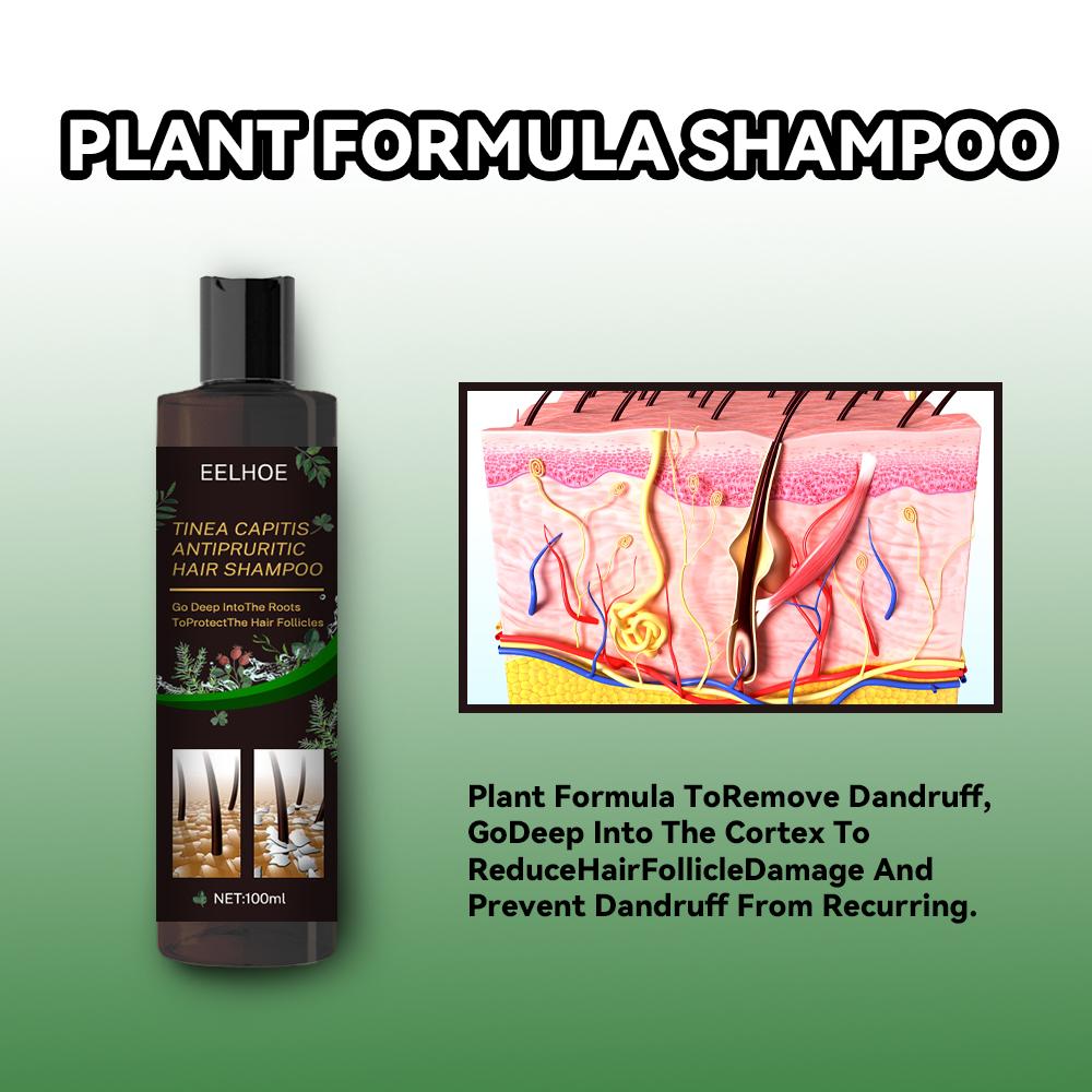 EELHOE Anti-Dandruff Shampoo Itch Relief, Hair Loss