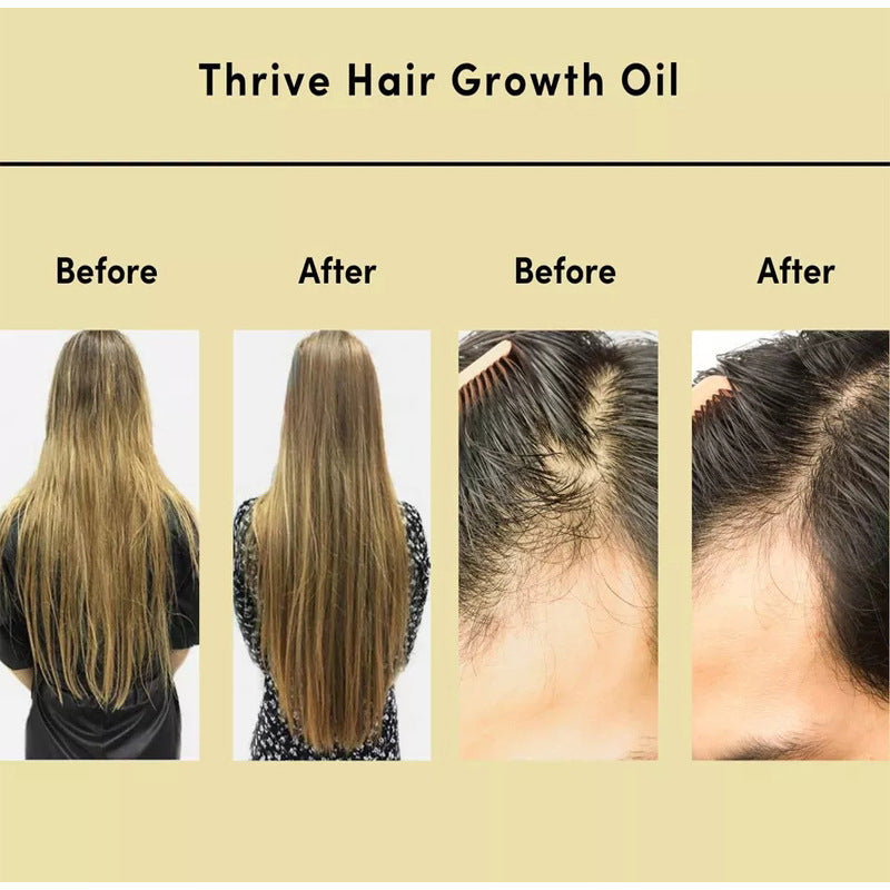 Hair Essential Oil Improve Dryness And Irritability Nourish