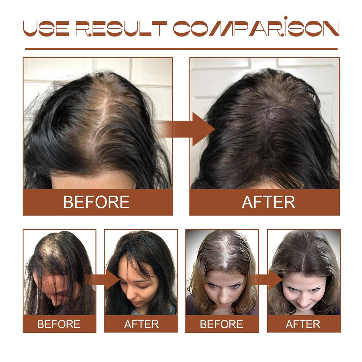 Batana Oil From Honduras Get Fuller, Thicker, Healthier Hair